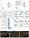 Increased abundance of memory B cells and depletion of IgA+ plasma cells ob