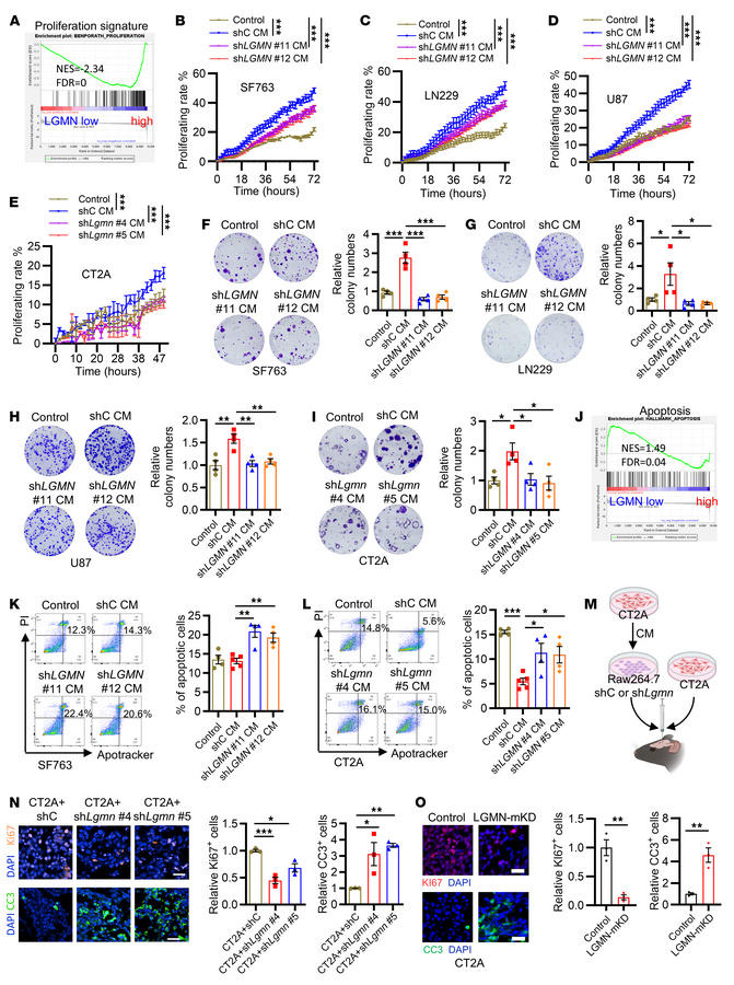 Macrophage-derived LGMN regulates GBM cell proliferation and apoptosis.
...