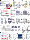 LGMN promotes macrophage infiltration in GBM.
