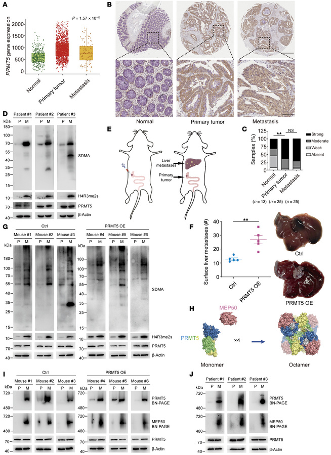 Increased PRMT5-MEP50 hetero-octamer level and PRMT5 methyltransferase a...