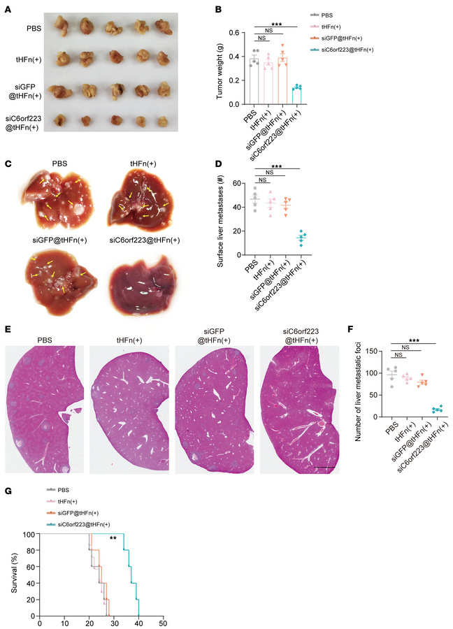 Targeting C6orf223 suppresses CRC tumor growth and metastasis in vivo.
(...