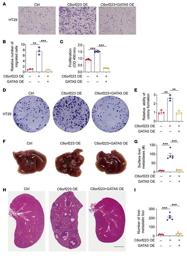 C6orf223 promotes CRC growth and metastasis through GATA5.
(A and B) Rep...