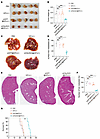 Targeting C6orf223 suppresses CRC tumor growth and metastasis in vivo.