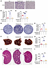 C6orf223 promotes CRC growth and metastasis through GATA5.