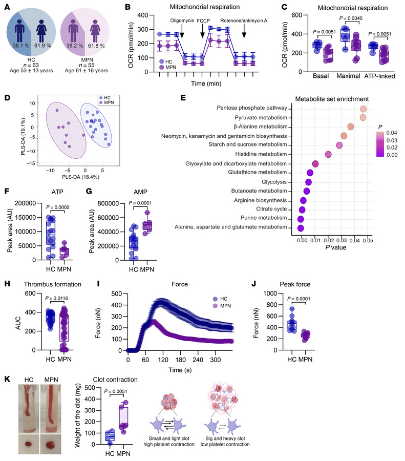 Metabolic and functional characterization of MPN platelets.
(A) Demograp...