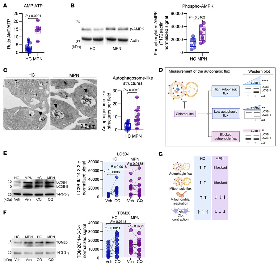 Assessment of autophagy pathways in MPN platelets.
(A) AMP/ATP ratios de...