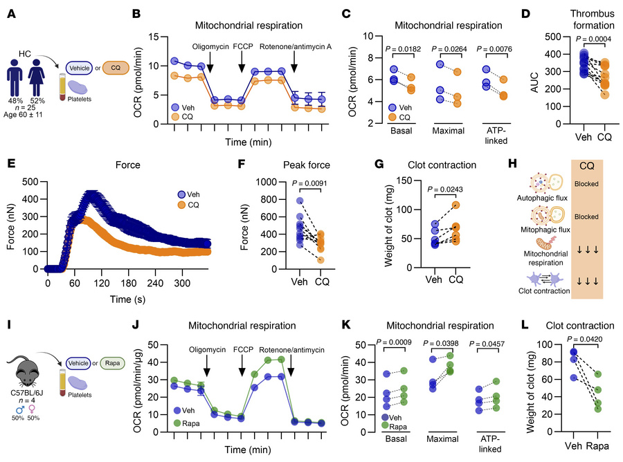Pharmacological inhibition of autophagy impairs mitochondrial respiratio...
