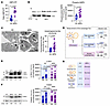 Assessment of autophagy pathways in MPN platelets.