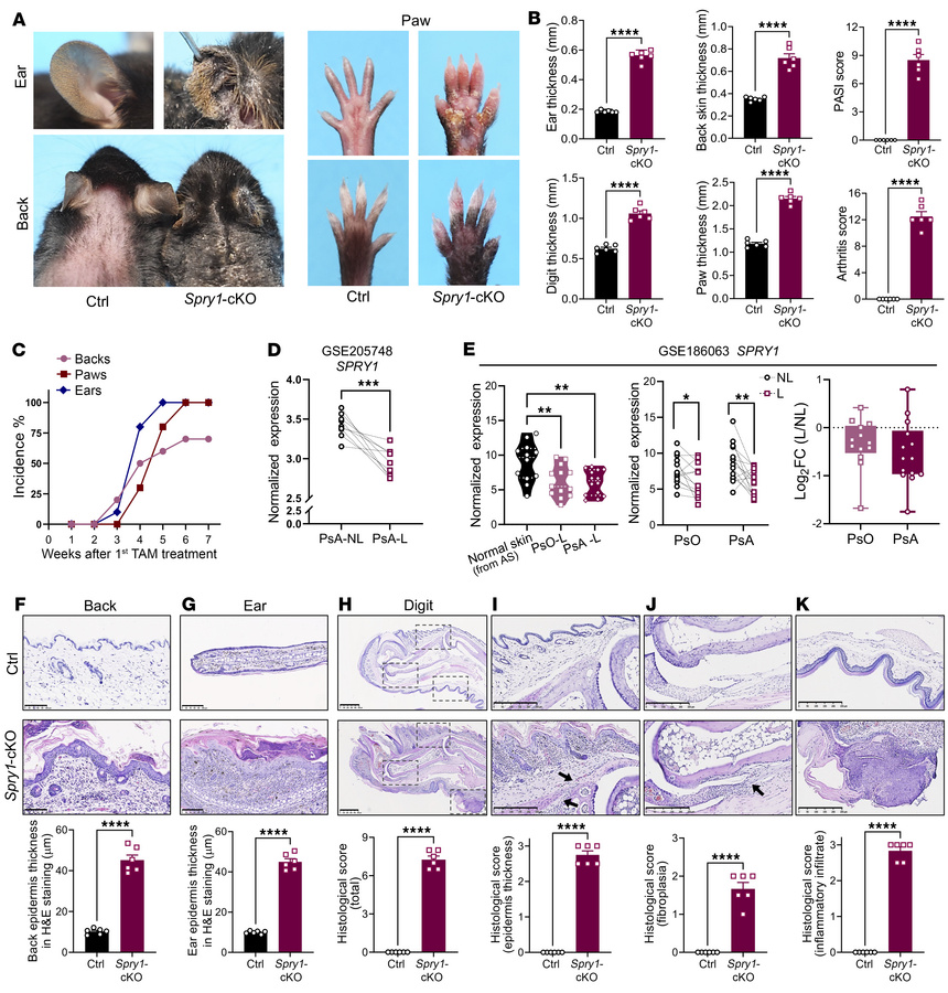 Epidermis-specific SPRY1-deficient mice spontaneously develop psoriasis-...