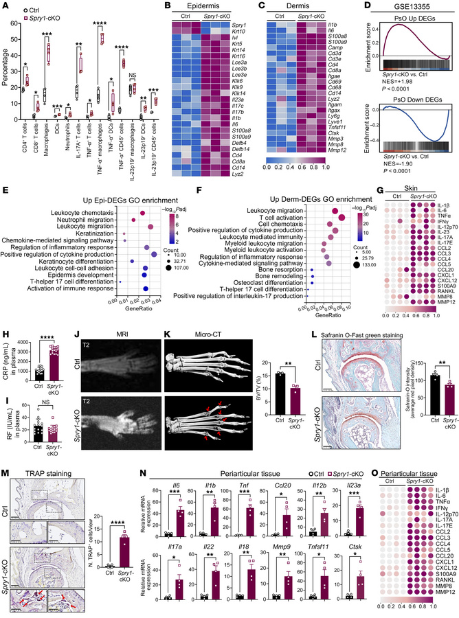 Skin and joint inflammation in Spry1-cKO mice exhibit hallmarks of psori...