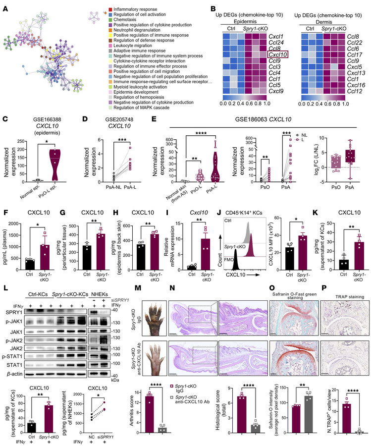 Excessive CXCL10 secreted by SPRY1-deficient keratinocytes promotes psor...