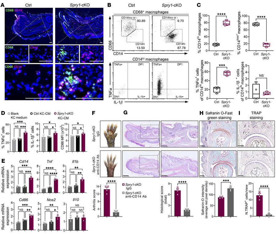 Periarticular CD14hi macrophages aggravate psoriatic arthritis–like infl...