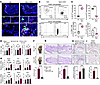 Periarticular CD14hi macrophages aggravate psoriatic arthritis–like inflamm