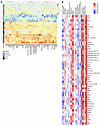 Correlation of high CI urine proteins with LN pathology and clinical parame