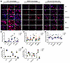 Complement C3a and C5a trigger the expression of ECM proteins in macrophage