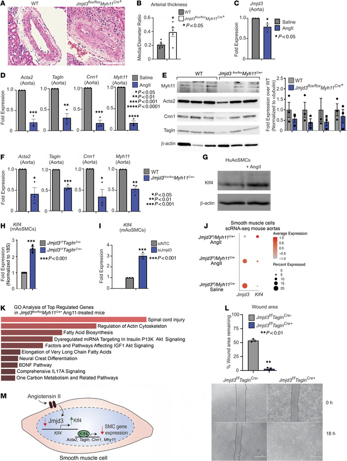 Hypertensive-induced arterial remodeling is regulated by JMJD3.
(A) H&am...