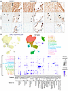 CDKL1 is expressed in VSMCs of normal and diseased aortic tissue.