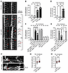 ISV malformation and aortic dilation in zebrafish cdkl1 morphants and crisp