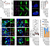 Consequences of CDKL1 variants for ciliary biology.