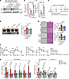 Beneficial effects of hGULL/mGULL on fatty liver are CRTC2 dependent.