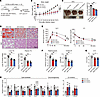 AAV-mediated hGULL/mGULL overexpression improves metabolic health of obese