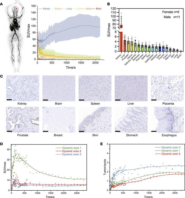 Dynamic PET imaging analysis.
(A) PET image of 1 patient 30 seconds afte...