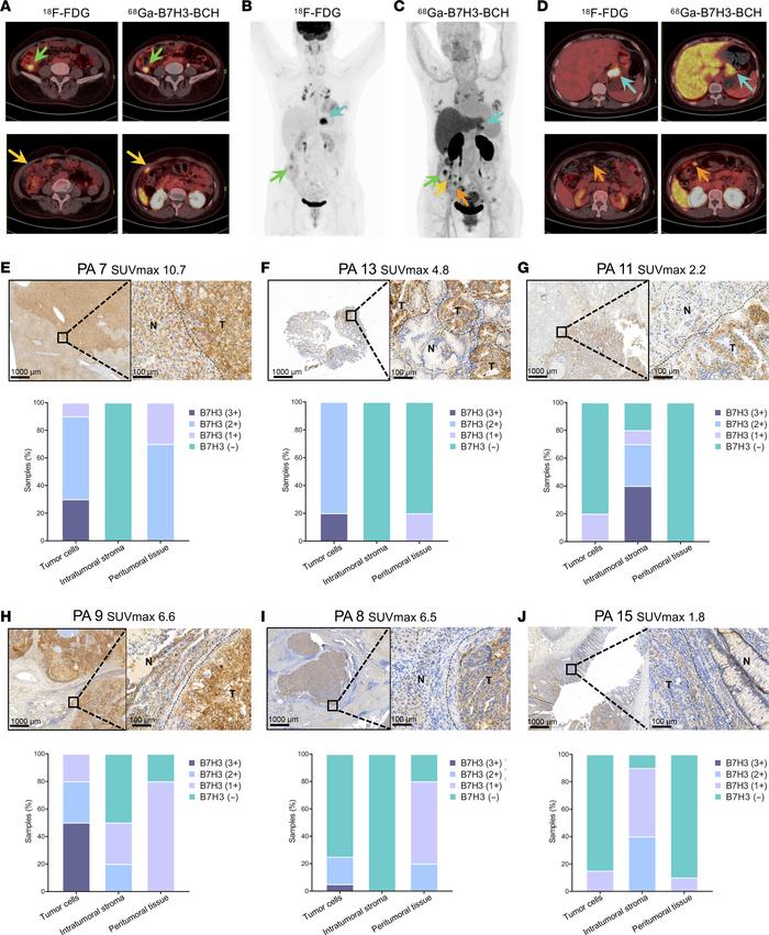 Advantages imaging and influence of variable B7H3 expression.
(A–D) Maxi...