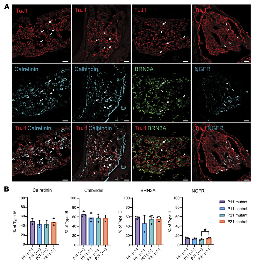 Spiral ganglion subtype composition is normal in Tmprss3Y260X/Y260X mice...
