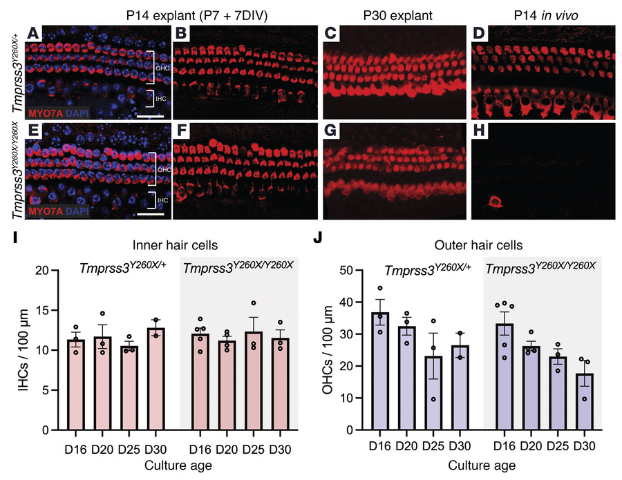 Cochlear explant cultures implicate intracochlear environment in HC deat...