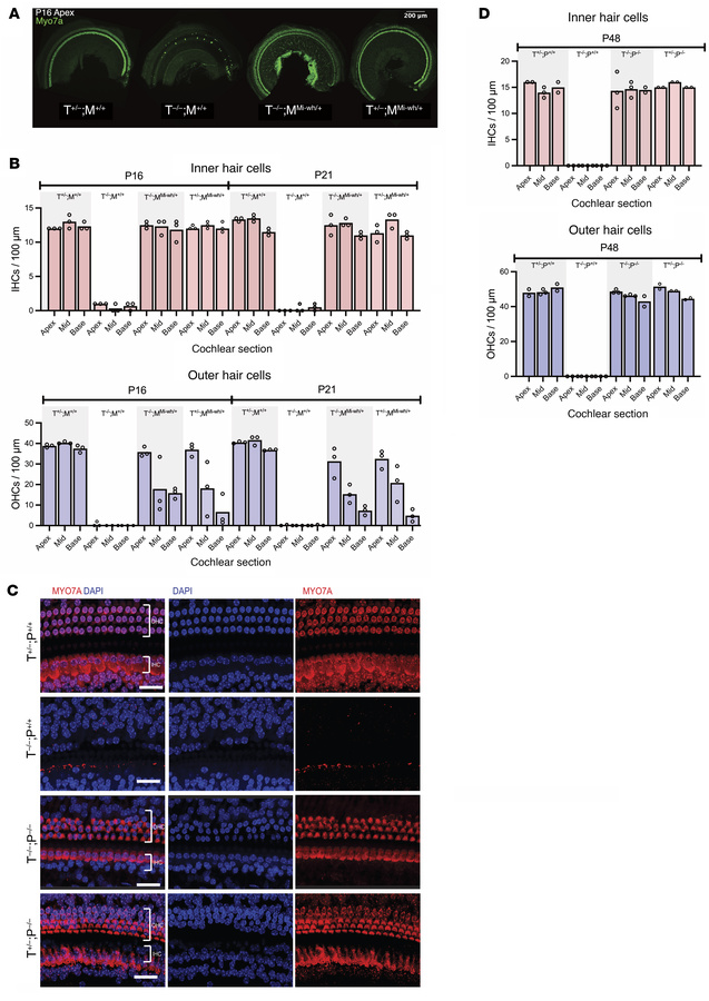 Rescue of cochlear HCs in Tmprss3Y260X/Y260X mice through reduction of E...