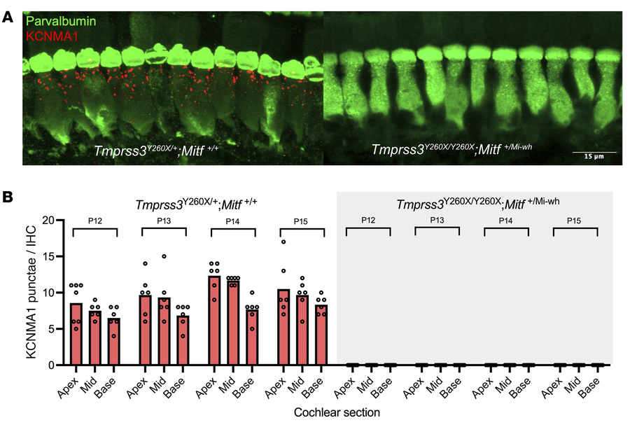 Reduced EP does not rescue KCNMA1 expression.
(A) Representative section...