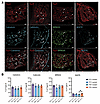 Spiral ganglion subtype composition is normal in Tmprss3Y260X/Y260X mice, a
