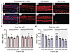 Cochlear explant cultures implicate intracochlear environment in HC death i