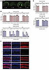 Rescue of cochlear HCs in Tmprss3Y260X/Y260X mice through reduction of EP v