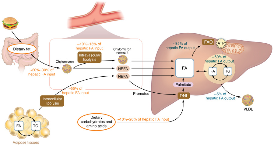 Interrelated mechanisms of intrahepatic triglyceride accretion in MASLD....