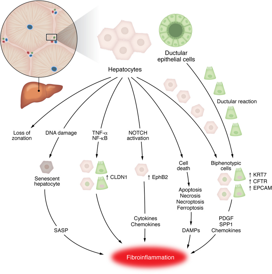 Epithelial plasticity in MASLD.
Hepatocytes and ductular epithelial cell...