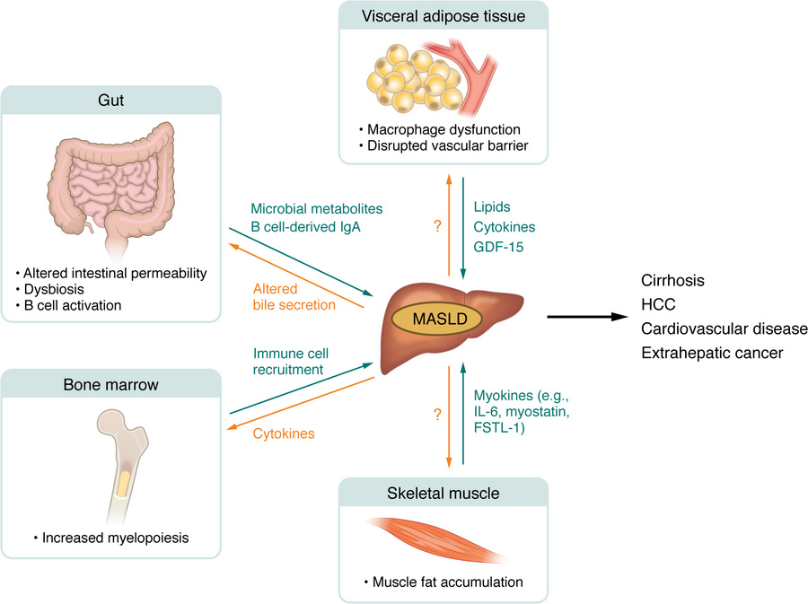 Systemic regulators of MASLD pathogenesis.
MASLD is part of a multisyste...