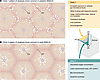 Patterns of steatosis distribution in pediatric MASLD.