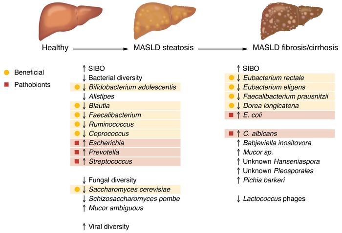Changes in the gut microbiota associated with MASLD.
Patients with steat...