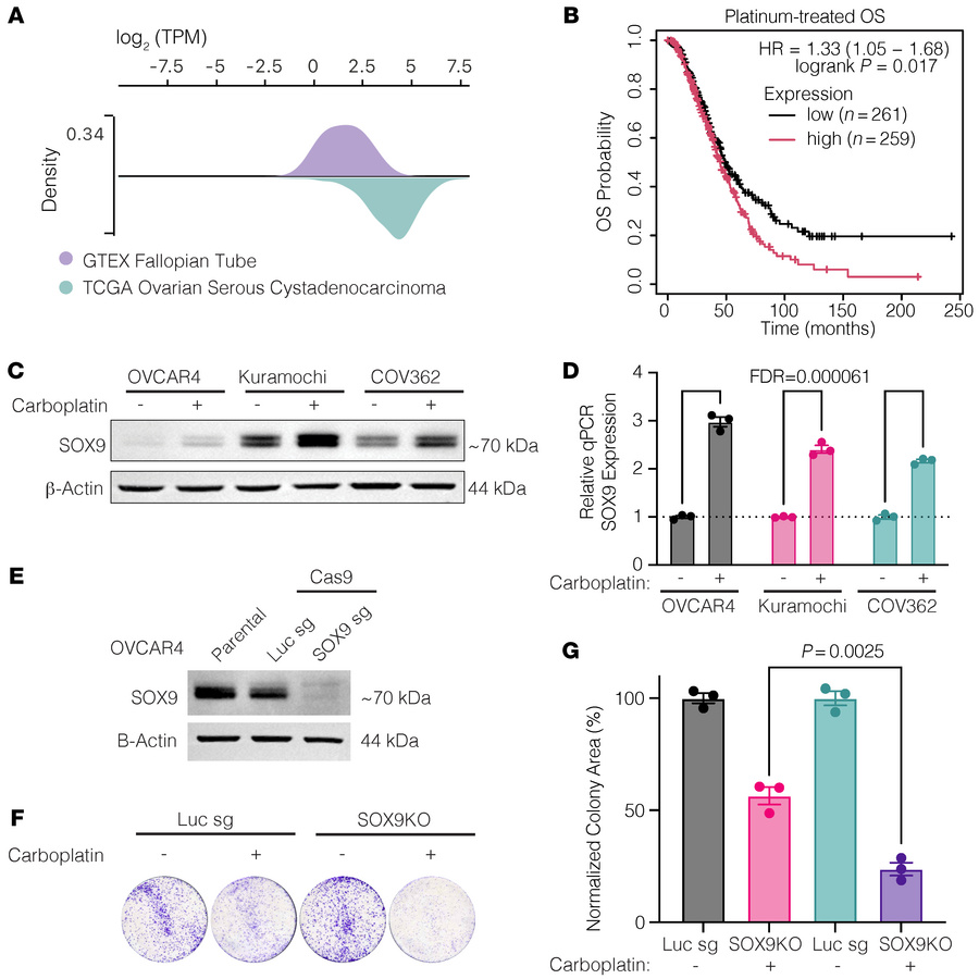 
SOX9 is overexpressed, is a poor prognostic indicator, and is induced b...