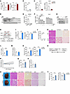 Inactivation of minor intron splicing caused by decrease in Zrsr1 and Zrsr2