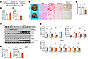 Reactivating minor intron splicing ameliorates MASH progression.