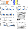Minor intron splicing deficiency activates SREBP1c-mediated de novo lipogen