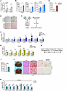 IDH1 induces ammonia accumulation in the liver, which triggers HSC activati