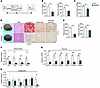 IDH1 inhibition blocks minor intron splicing deficiency–induced MASH progre