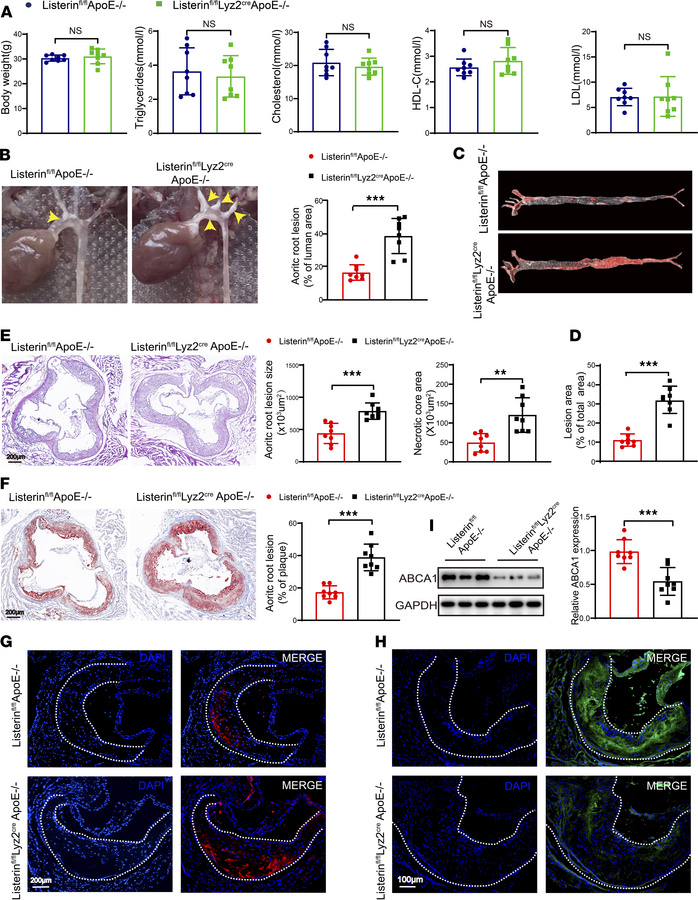 Listerin KO aggravates the development of atherosclerosis in vivo.
Male ...