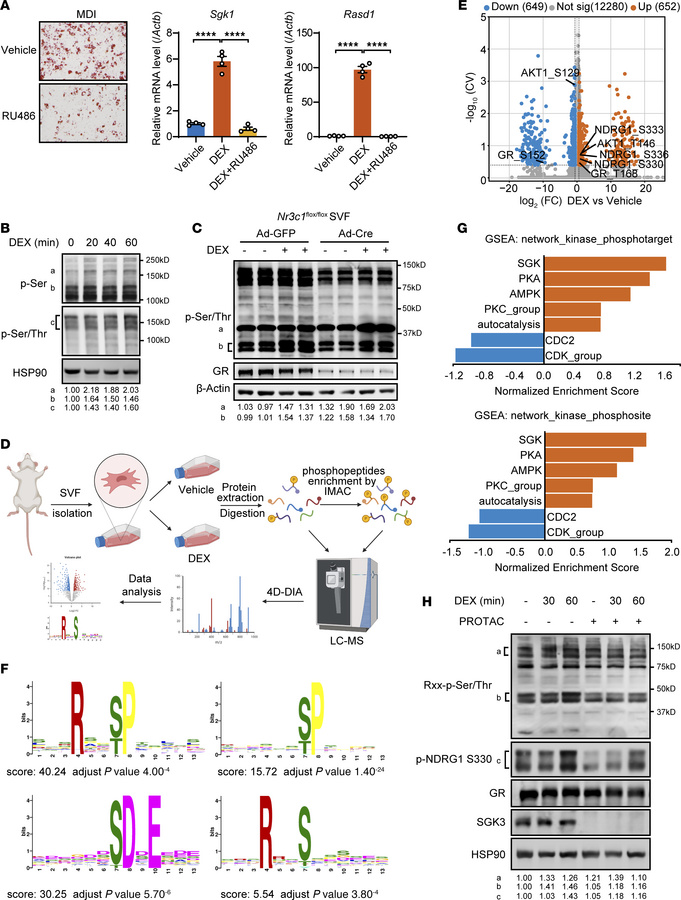 SGK3 is essential for protein phosphorylation in response to glucocortic...