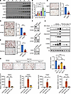 SGK3 regulates adipogenesis.