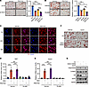 SGK3 regulates adipogenesis independently of GR signaling.