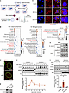 Glucocorticoid-induced nuclear SGK3 translocation during early stage of pre